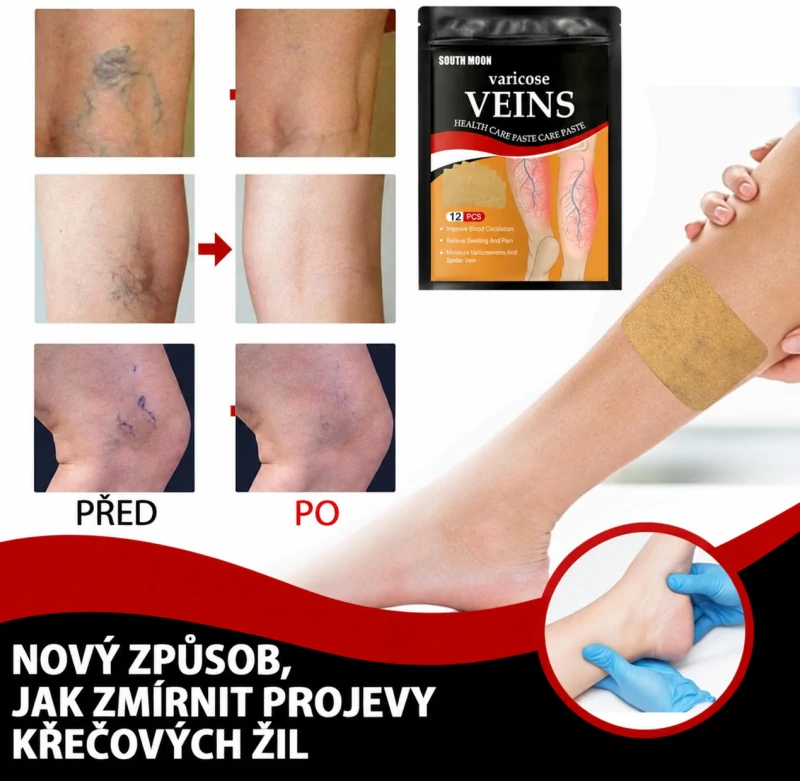 Náplasti na křečové žíly - Obrázek 3