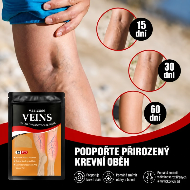 Náplasti na křečové žíly - Obrázek 4
